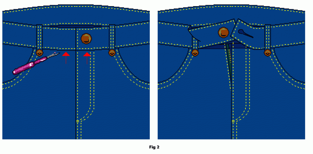 Unpick lower stitching of waistband to free top end of fly zip. Unpick lower stitching of waistband to free top end of fly zip.