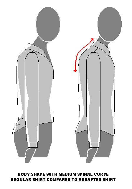 Ordinär skjorta på en person med böjd nacklinje och därefter anpassad skjorta på samma person