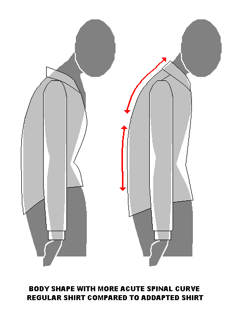 Ordinär skjorta på en person med böjd nack- och rygglinje och därefter anpassad skjorta på samma person